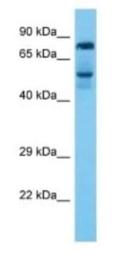 Rhophilin 2 Rabbit anti-Human, Polyclonal, Novus Biologicals:Antibodies:Primary